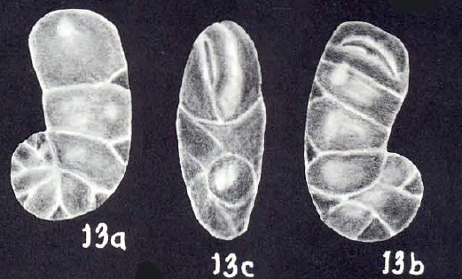 Heterocassidulina (?) margaritaensis McCulloch, 1981