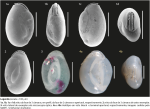 Pseudolachlanella bermudezi (Acosta, 1940)
1a, 1b, 1c and 1d) the three-chamber face, the edge, the two-chamber face, and the apertural view, respectively; 2) the three-chamber face of another specimen; 3) lateral view of a specimen observed under optical microscopy; 4a and 4b) holotype in lateral and apertural views, respectively; the last two images were provided by the NMNH - Smithsonian Institution.