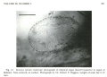 Deeveya spiralis Kornicker & Iliffe, 1985 from the original description