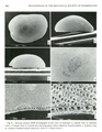 Deeveya spiralis Kornicker & Iliffe, 1985 from the original description