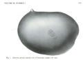 Deeveya spiralis Kornicker & Iliffe, 1985 from the original description