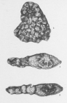 Miogypsina (Miogypsinella) bermudezi Drooger, 1951