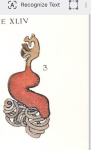 Lernaea minuta 