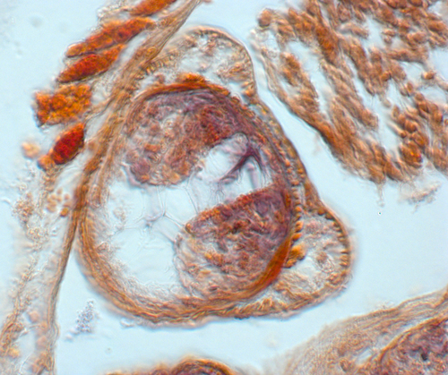 Holotype