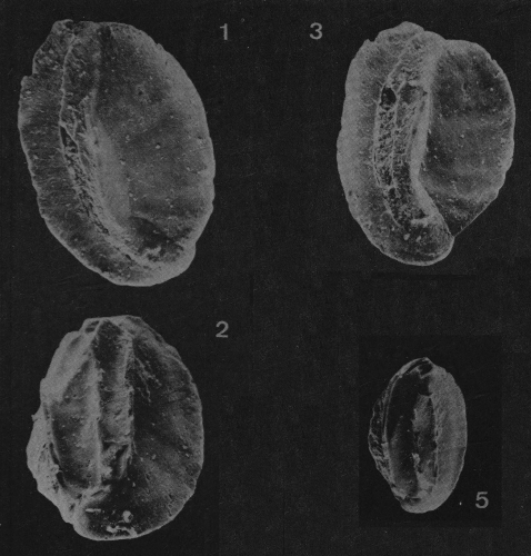Quinqueloculina thumae Just, 1977