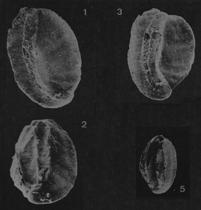 Quinqueloculina thumae Just, 1977