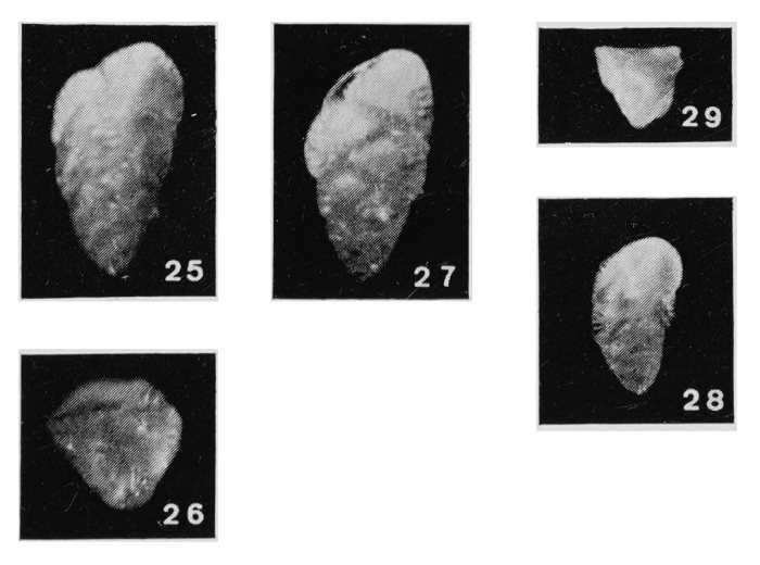 Reussella limboperforata Margerel, 1968