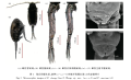 Pseudodiaptomus zhengi habitus