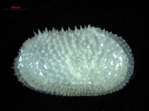 Echinocythere from the seas off Iceland
