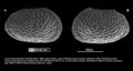Paralectotype of Cythereis echinata Sars, 1866 from Brandão & Karanovic, 2015