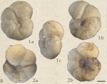 Anomalinoides granosus (Hantken, 1875)