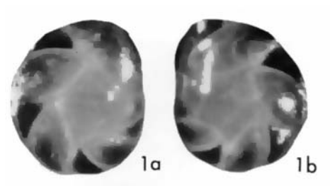 Cassidulina neoteretis Seidenkrantz, 1995 holotype