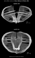 Abrochtha carnivora
