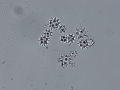 Aurora actinosa Oxyspherasters of holotype