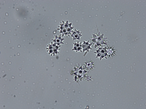 Aurora actinosa Oxyspherasters of holotype