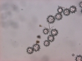 Spicules of holotype
