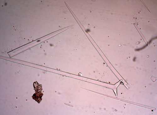 Holotype spicules