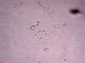 Holotype spicule