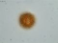 Pollen grain of Vernonia hispidula var. glabriuscula, Humbert, H., 3481, P00621427