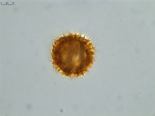 Pollen grain of Vernonia hispidula var. glabriuscula, Humbert, H., 3481, P00621427