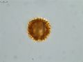 Pollen grain of Vernonia hispidula var. glabriuscula, Humbert, H., 3481, P00621427