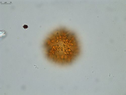 Pollen grain of Vernonia hispidula var. glabriuscula, Humbert, H., 3481, P00621427
