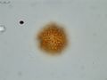 Pollen grain of Vernonia hispidula var. glabriuscula, Humbert, H., 3481, P00621427
