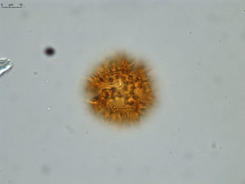 Pollen grain of Vernonia hispidula var. glabriuscula, Humbert, H., 3481, P00621427