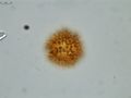 Pollen grain of Vernonia hispidula var. glabriuscula, Humbert, H., 3481, P00621427