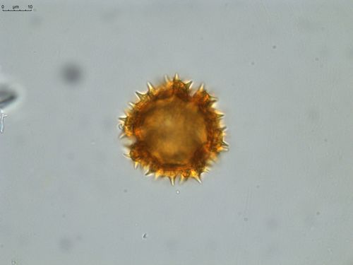 Pollen grain of Vernonia hispidula var. glabriuscula, Humbert, H., 3481, P00621427