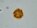 Pollen grain of Vernonia hispidula var. glabriuscula, Humbert, H., 3481, P00621427