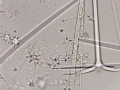 Holotype, microscleres