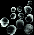 Eusphaeroidina inflata Ujiié, 1990