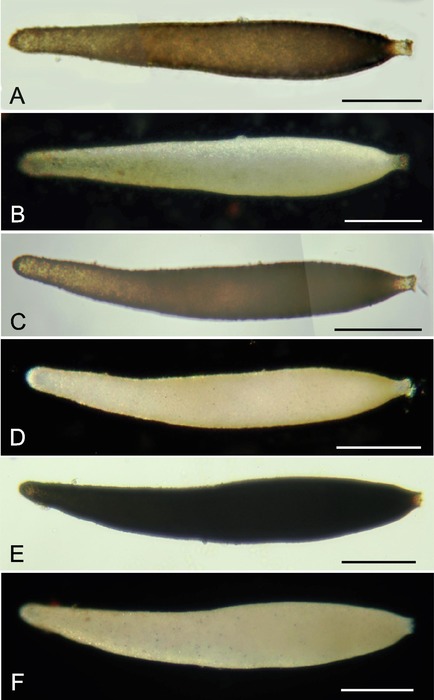 Pseudoconqueria lenticularis Holzmann, Gooday, Majewski &amp; Pawlowski, 2022