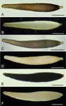 Pseudoconqueria lenticularis Holzmann, Gooday, Majewski & Pawlowski, 2022