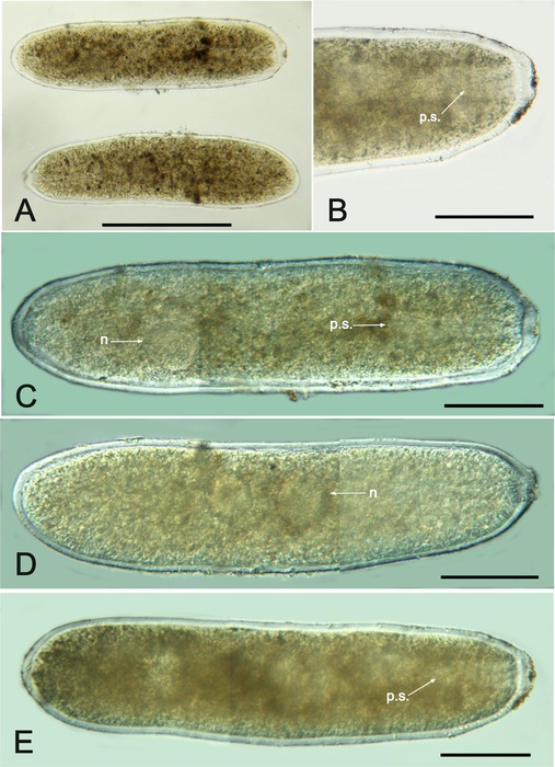 Limaxia alba Holzmann, Gooday, Majewski &amp; Pawlowski, 2022