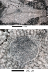 Virgasterocyclina ferrandezi subsp. lessi Ferràndez-Cañadell & Baumgartner-Mora, 2023   