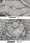 Virgasterocyclina ferrandezi subsp. lessi Ferràndez-Cañadell & Baumgartner-Mora, 2023   