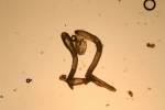 Bryozoa