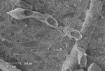 Bryozoa