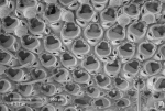 Bryozoa