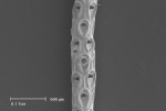 Bryozoa