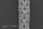 Bryozoa
