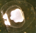 Hydrozoa