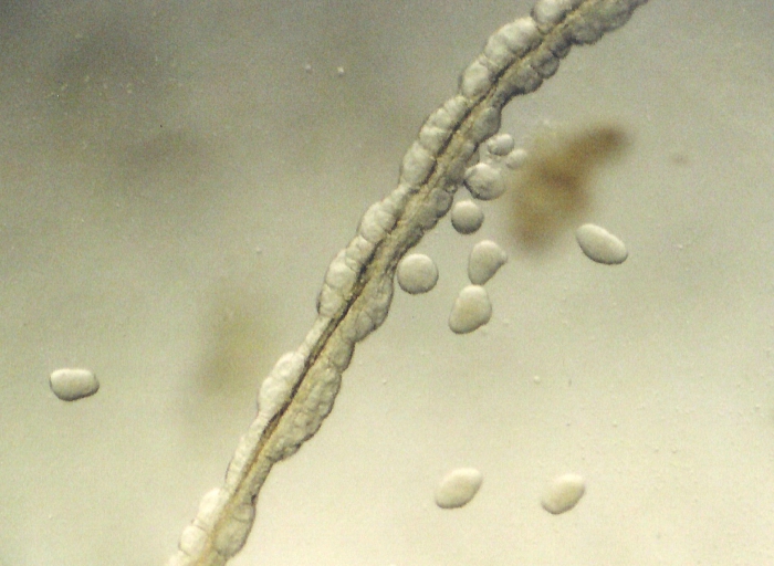 Eucheilota maculata Eucheilota maculata