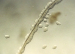 Hydrozoa