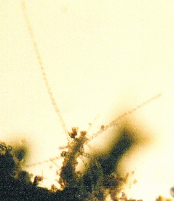 Rathkea octopunctata Rathkea octopunctata
