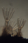 Bryozoa