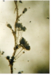 Medusae