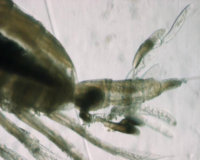 Calanus finmarchicus, spermatophores, high mag, 8,5x Calanus finmarchicus, spermatophores, high mag, 8,5x